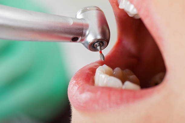 Best Weekend Emergency Dentist in Sandia Knolls, NM